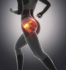 imagem de Impacto Femoroacetabular