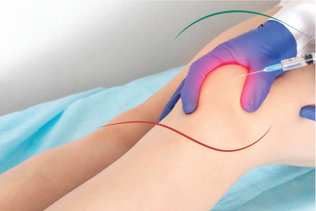 Procedimento Infiltração no joelho